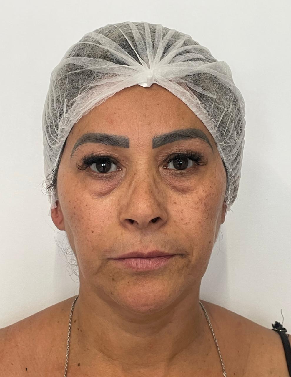 Antes da harmonização