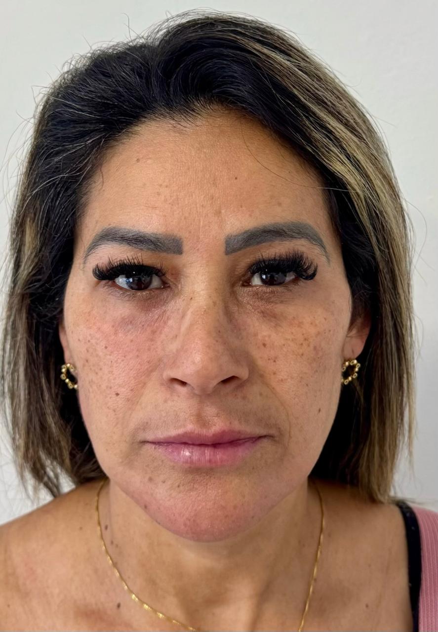 Depois da harmonização