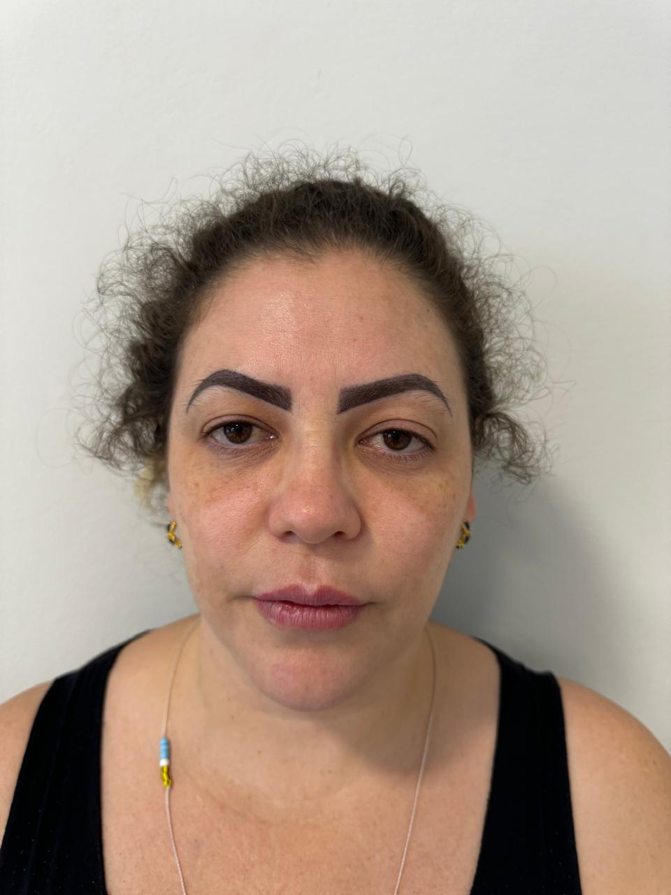 Antes da harmonização