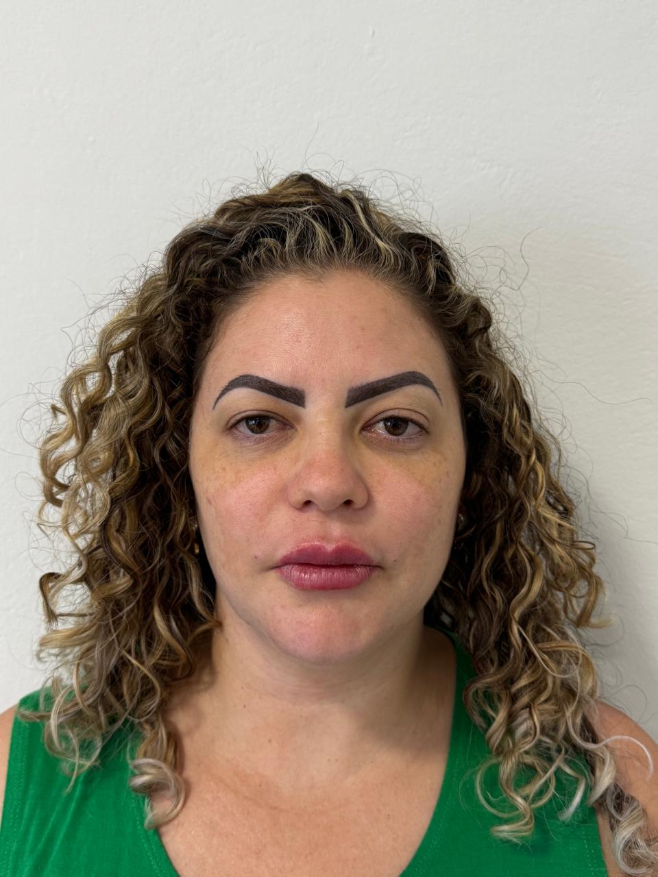 Depois da harmonização