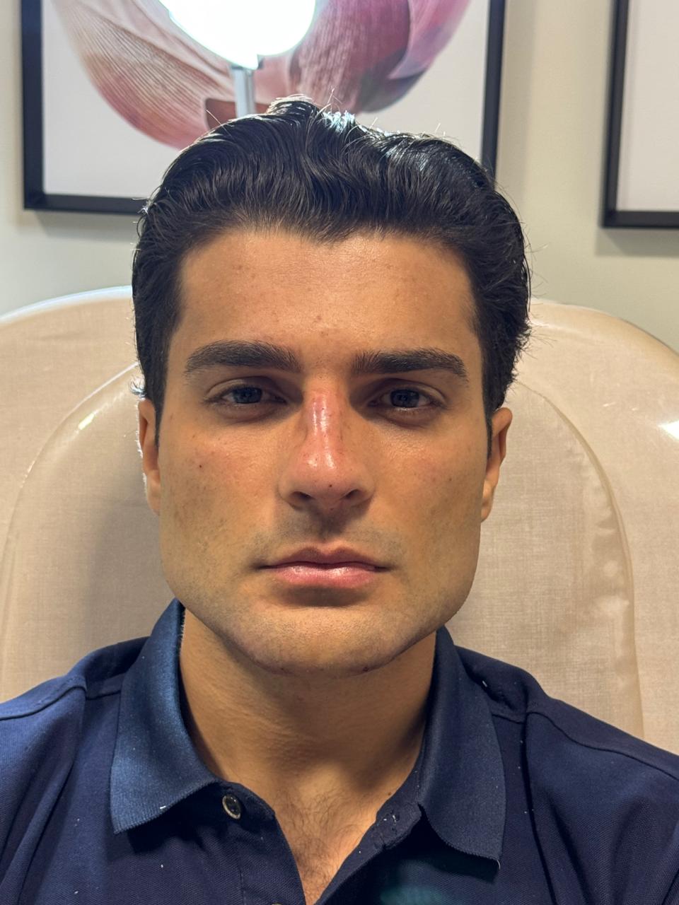 Depois da harmonização