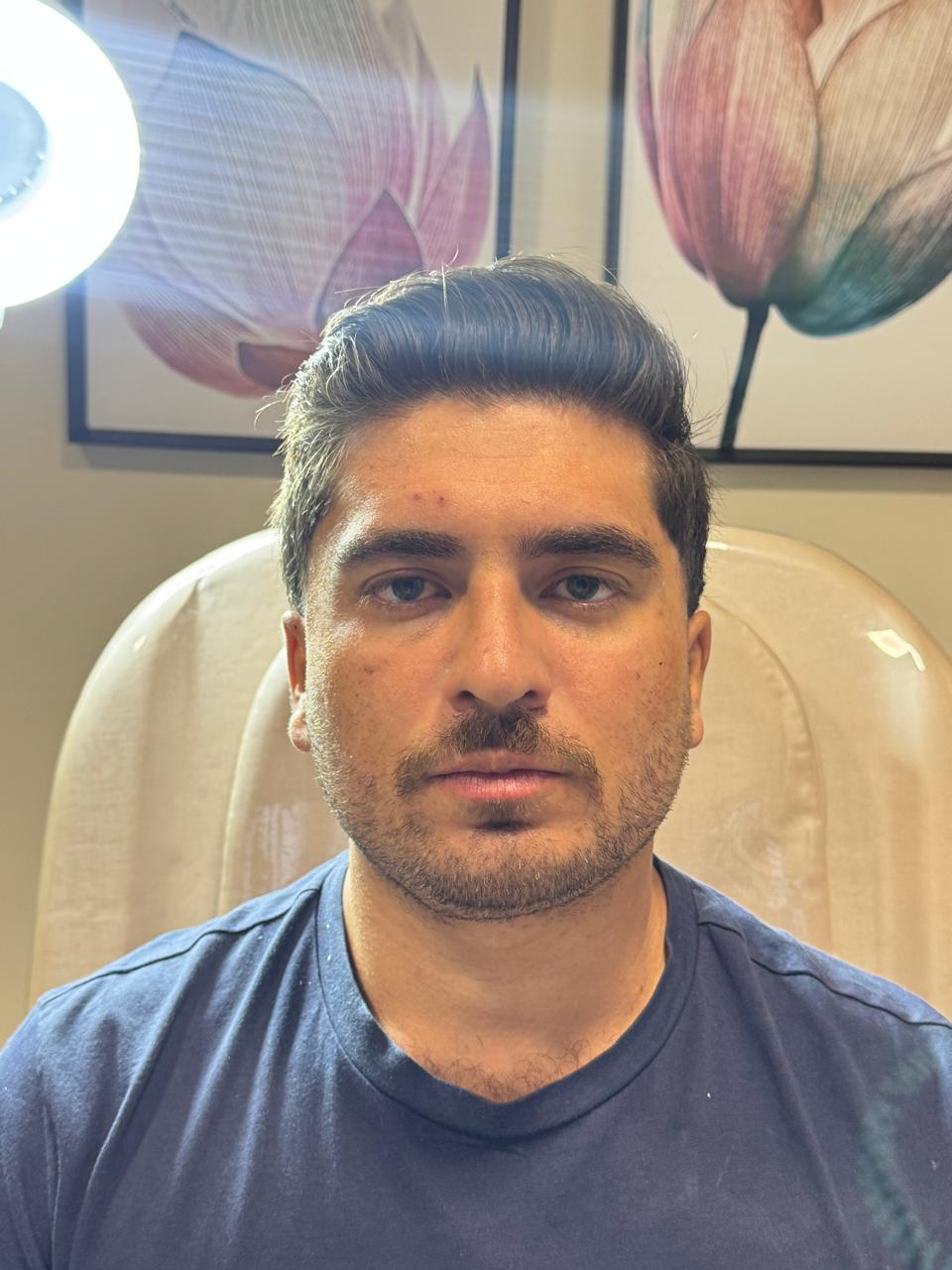 Antes da harmonização