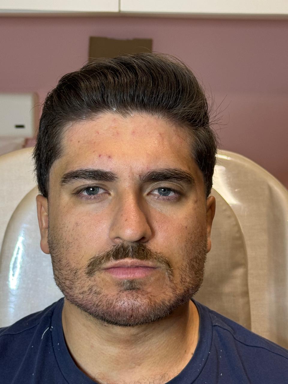 Depois da harmonização