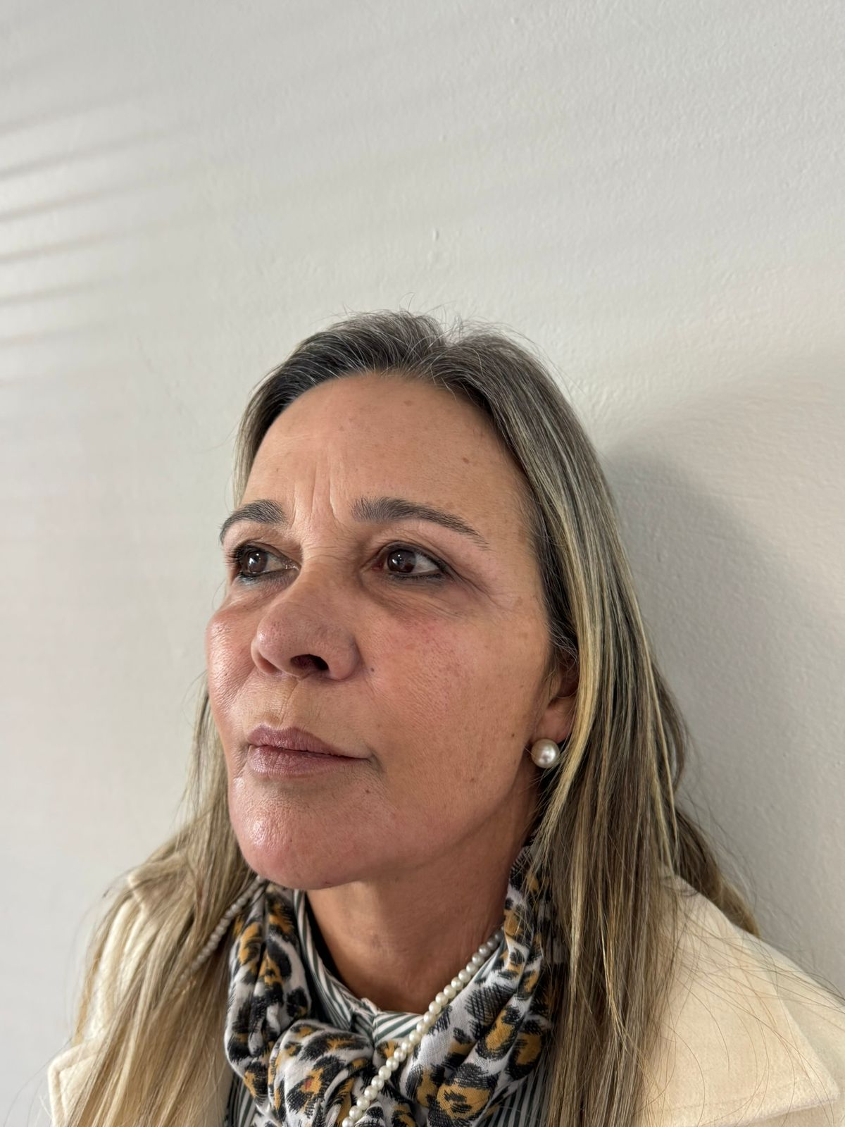 Depois da harmonização